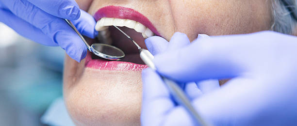 Best Broken or Chipped Tooth Repair in Shasta Lake, CA